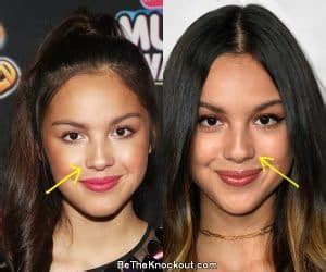 does olivia rodrigo have implants|Olivia Rodrigo Plastic Surgery Comparison Photos